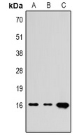 Histone H3 (TriMethyl-K4) Antibody