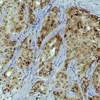 Histone H3 (TriMethyl-K4) Antibody