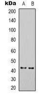 KCNK9 Rabbit Polyclonal Antibody