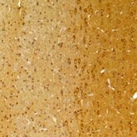 KCNK9 Rabbit Polyclonal Antibody