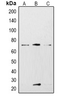 KCNN2 Rabbit Polyclonal Antibody