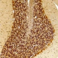 KCNN2 Rabbit Polyclonal Antibody