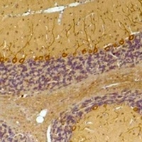 Kv1.8 Rabbit Polyclonal Antibody
