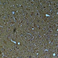 Kv11.3 Rabbit Polyclonal Antibody