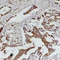 MKK5 Rabbit Polyclonal Antibody