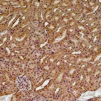 SOD2 Rabbit Polyclonal Antibody