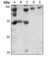 FOXO1 (Phospho-S256) Rabbit Polyclonal Antibody