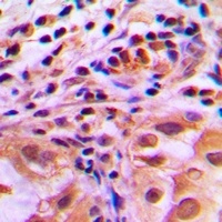 FOXO1 (Phospho-S256) Rabbit Polyclonal Antibody