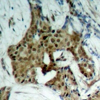 STAT1 (Phospho-Y701) Antibody
