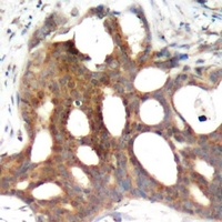 Estrogen Receptor alpha (Phospho-S104) Rabbit Polyclonal Antibody