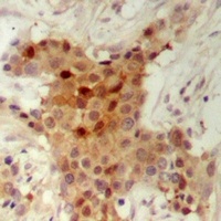 HER2 Rabbit Polyclonal Antibody
