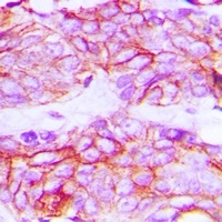 VEGFR2 (Phospho-Y1214) Rabbit Polyclonal Antibody