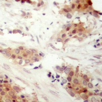 Cyclin D3 (Phospho-T283) Rabbit Polyclonal Antibody