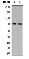 PKC theta (Phospho-S695) Rabbit Polyclonal Antibody