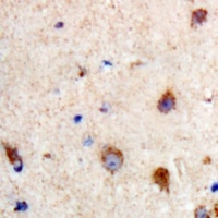PKC theta (Phospho-S695) Rabbit Polyclonal Antibody