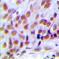 hNRNP C (Phospho-S260) Rabbit Polyclonal Antibody