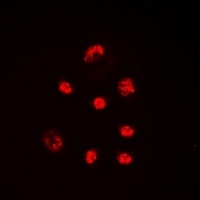 Lupus La (Phospho-S366) Rabbit Polyclonal Antibody