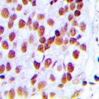 Ku80 Rabbit Polyclonal Antibody