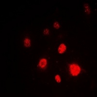 Ku80 Rabbit Polyclonal Antibody