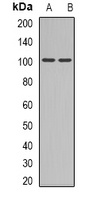 GLUR4 Rabbit Polyclonal Antibody