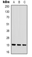 STMN1 (Phospho-S16) Rabbit Polyclonal Antibody