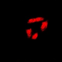 BRCA1 (Phospho-S1423) Rabbit Polyclonal Antibody