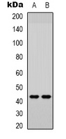 JUND (Phospho-S255) Antibody