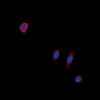 NTR1 Rabbit Polyclonal Antibody