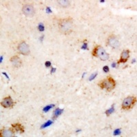PKC theta Rabbit Polyclonal Antibody