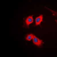 PKC theta Rabbit Polyclonal Antibody