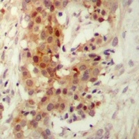 PKC iota/zeta Rabbit Polyclonal Antibody