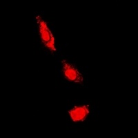 PKC iota/zeta Rabbit Polyclonal Antibody