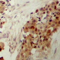 p38 (Phospho-Y182) Antibody