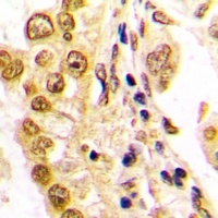 JUND Rabbit Polyclonal Antibody