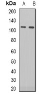 RB1 (Phospho-S795) Rabbit Polyclonal Antibody