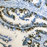 RB1 (Phospho-S795) Rabbit Polyclonal Antibody