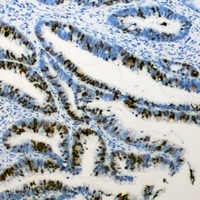 RB1 (Phospho-S807) Rabbit Polyclonal Antibody