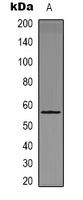 CHK1 (Phospho-S301) Rabbit Polyclonal Antibody