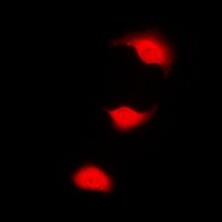 CHK1 (Phospho-S301) Rabbit Polyclonal Antibody