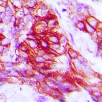 Syntaxin 1A (Phospho-S14) Rabbit Polyclonal Antibody