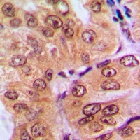 SMAD2 Rabbit Polyclonal Antibody