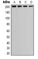 TSC2 Rabbit Polyclonal Antibody