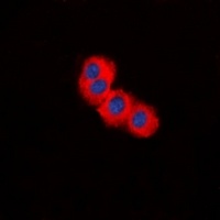 TSC2 Rabbit Polyclonal Antibody