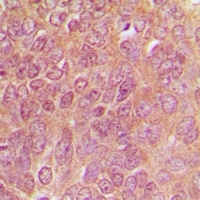 TPH1 Rabbit Polyclonal Antibody