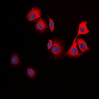 TPH1 Rabbit Polyclonal Antibody