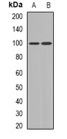 UBF Rabbit Polyclonal Antibody