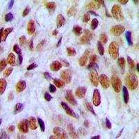 UBF Rabbit Polyclonal Antibody