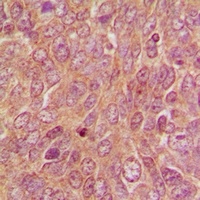 DUSP9 Rabbit Polyclonal Antibody