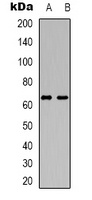 DCP1A Antibody