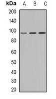 Plakophilin 2 Rabbit Polyclonal Antibody